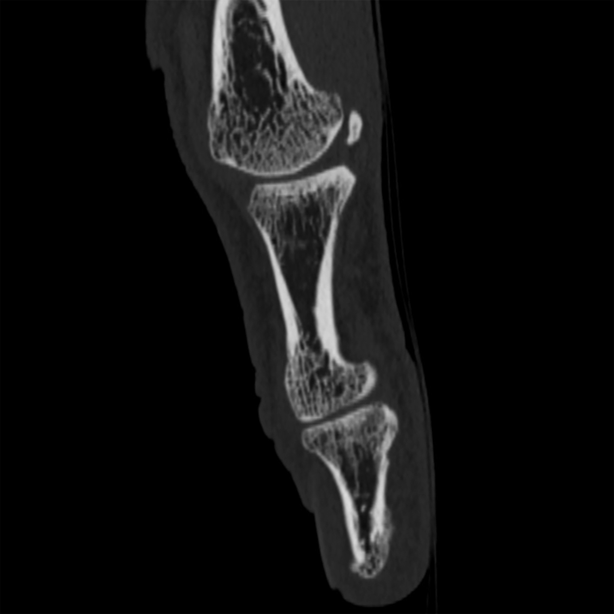 Scanner images d'examen