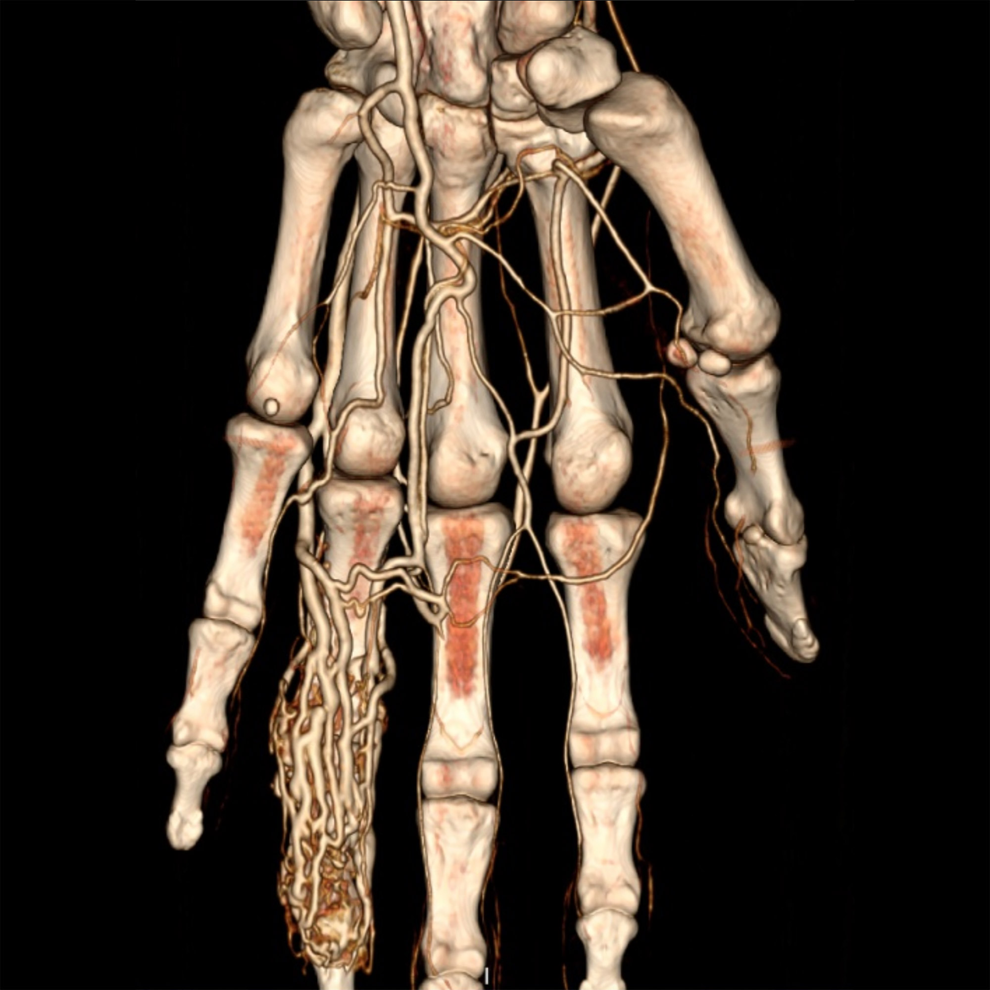 Scanner images d'examen