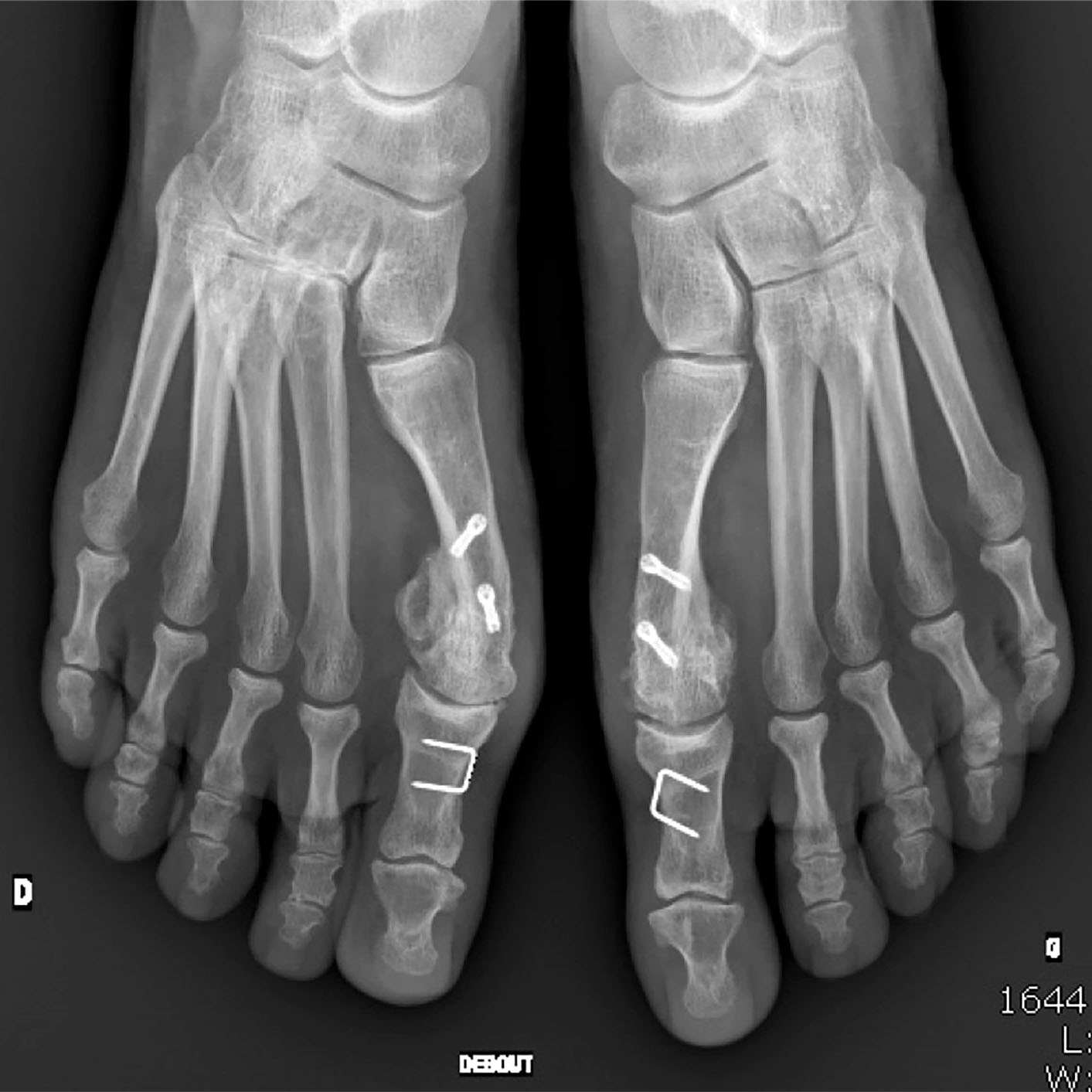 Radiographie images d'examen