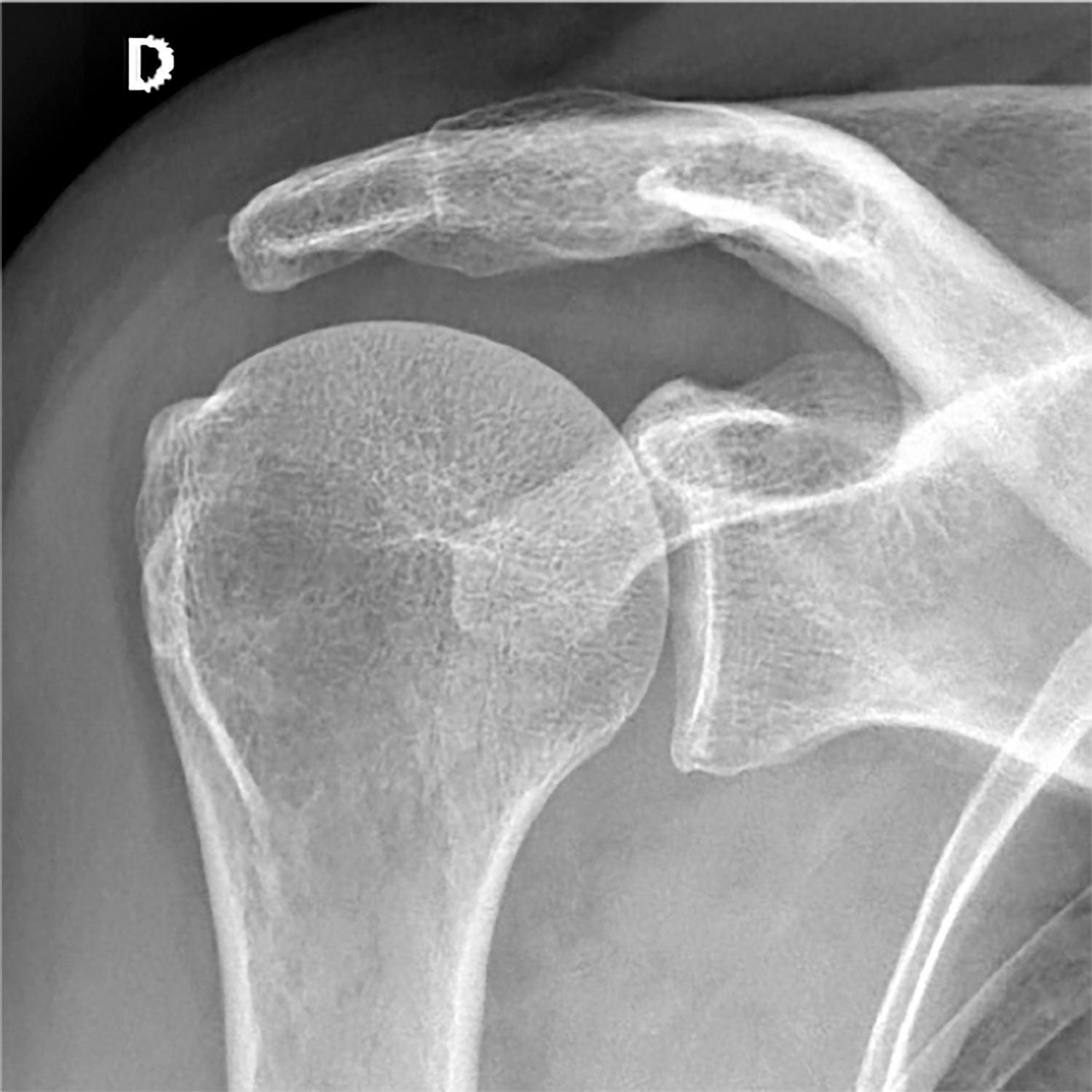 Radiographie images d'examen
