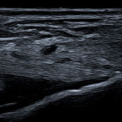 Échographie images d'examen