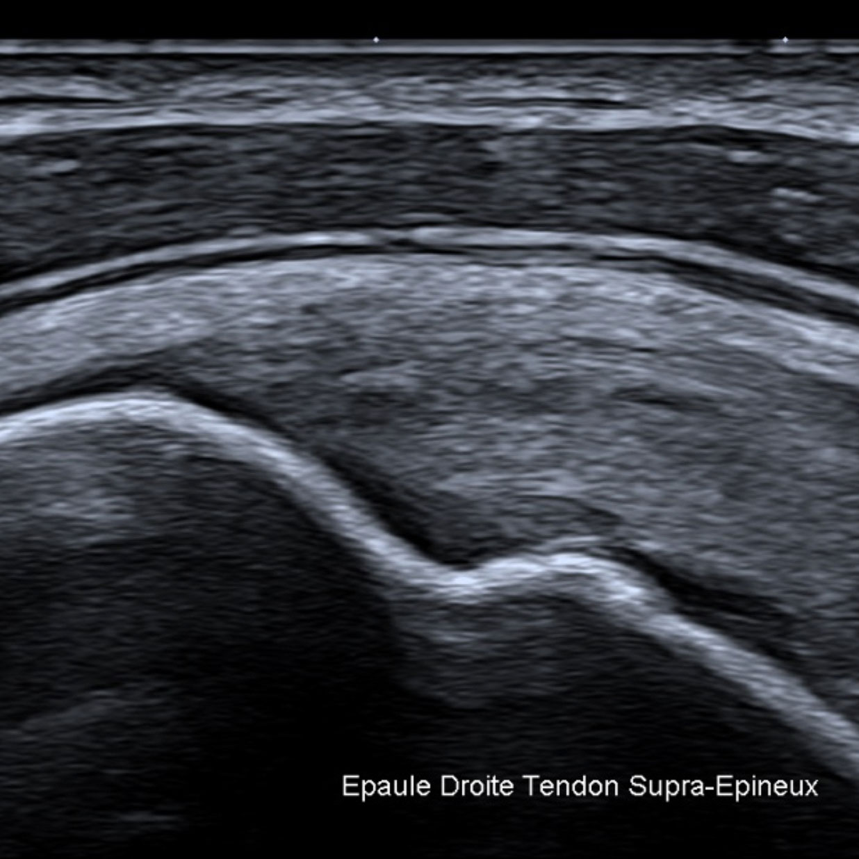 Échographie images d'examen